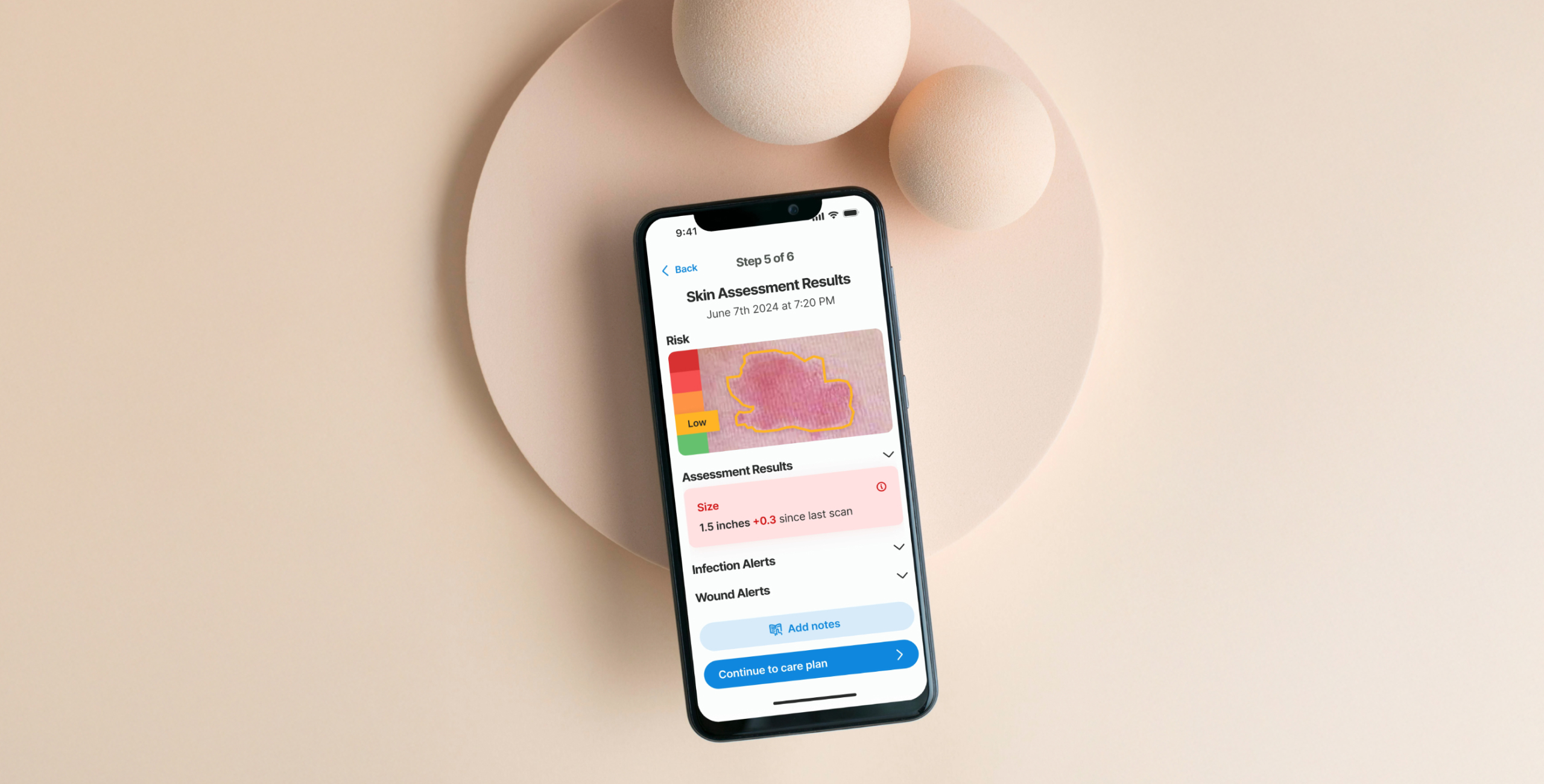 Smartphone screen displaying a skin assessment result with a highlighted area indicating risk levels and wound alerts.